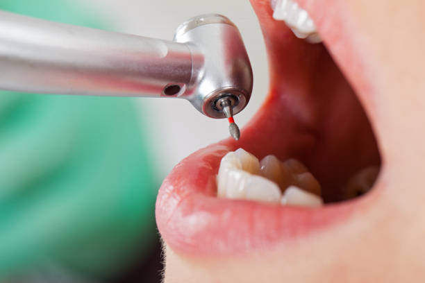 Best Orthodontic Emergency Dentist in Decatur, GA